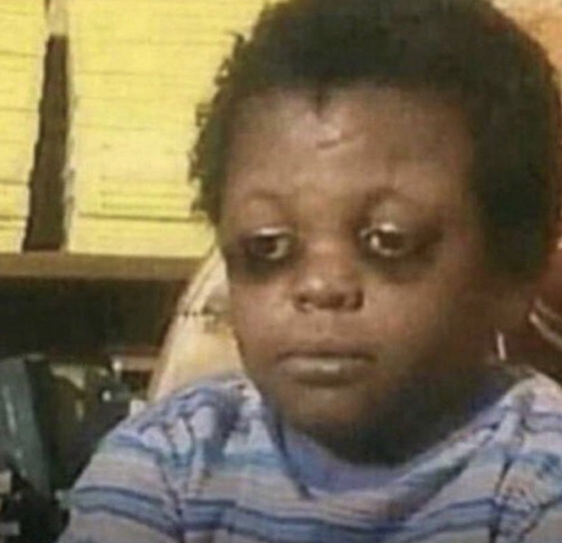 Ảnh chế mắt thâm thú vị