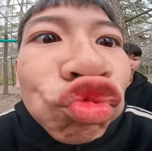 Meme chu môi quá đà